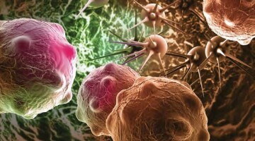 Иммунотерапия меланомы – как достичь наилучших результатов