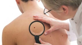 Расширяя возможности для лечения пациентов с BRAF+ метастатической меланомой: комбинация таргетной и иммунной терапии в реальной клинической практике